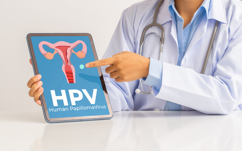 Samoodběr na HPV DNA – projekt ASTRA 
